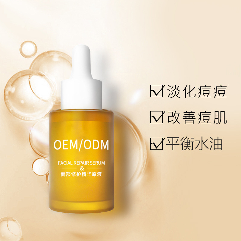 大同市_祛痘精华原液OEM